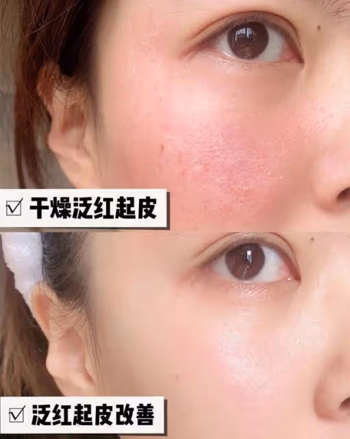 張馨予曬「合影」秀恩愛,卻因「皮膚細膩」被贊,自用面霜也火了