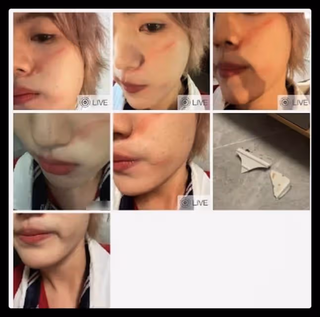 25歲男星被指控打人!直接拿碗砸向好友,受害者臉上傷痕令人後怕