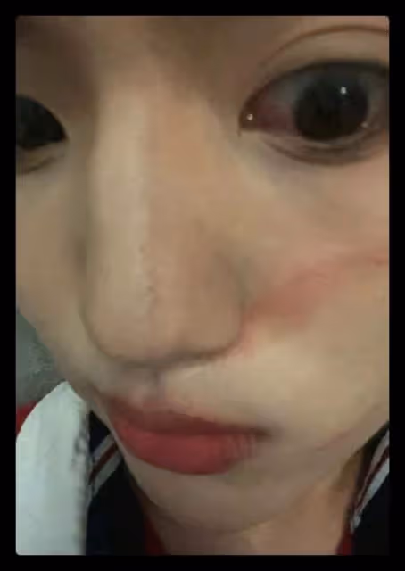 25歲男星被指控打人!直接拿碗砸向好友,受害者臉上傷痕令人後怕