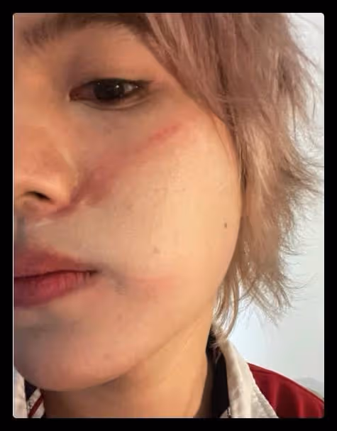 25歲男星被指控打人!直接拿碗砸向好友,受害者臉上傷痕令人後怕