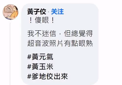 49歲男星首次當爸顯焦慮,看寶寶B超照淚崩,2特徵神似其去世愛犬