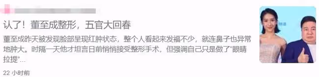 知名男星董至成鼻子變大被質疑整容!承認做了微整,但只動過眼睛
