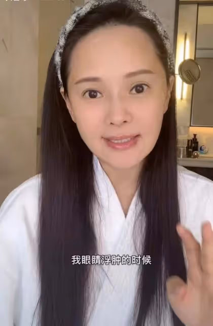 53歲伊能靜大方承認整容!直言又不是見不得人,與舊照對比太明顯