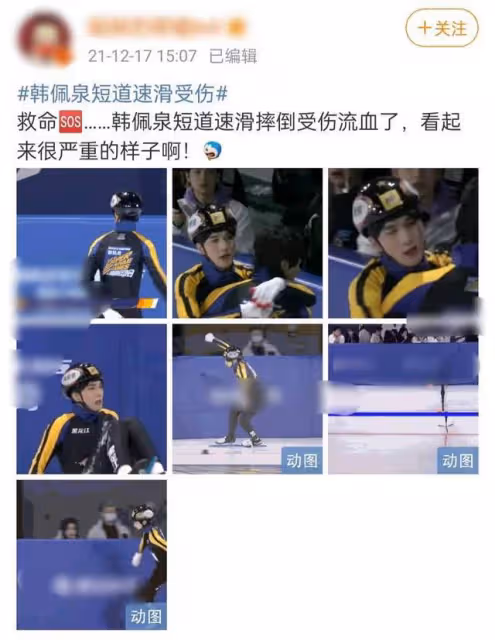 21歲男星錄節目受傷嚴重,多次摔倒臉著地,眼角流血到下巴太恐怖