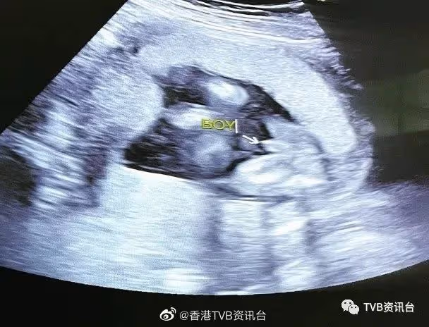 恭喜！TVB女星宣布二胎懷仔仔