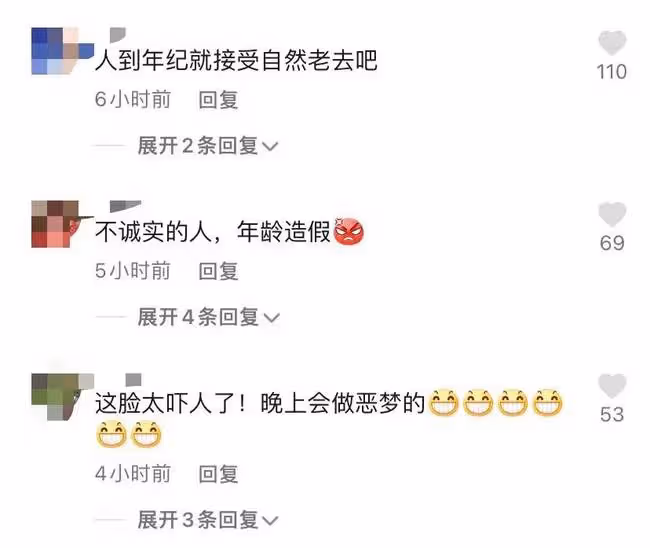 劉曉慶出鏡被指臉太嚇人,面部凹凸不平沒有皺紋,曾多次回復整容