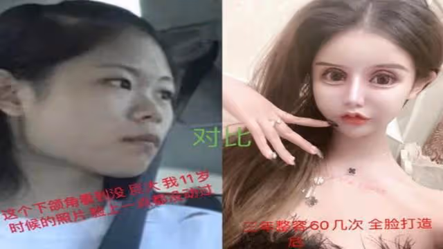 花費近百萬,網紅女孩3年整容60次,前後判若兩人,如今怎樣了?