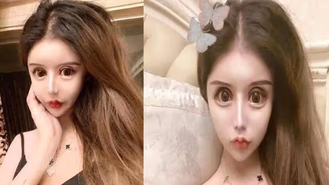 花費近百萬,網紅女孩3年整容60次,前後判若兩人,如今怎樣了?
