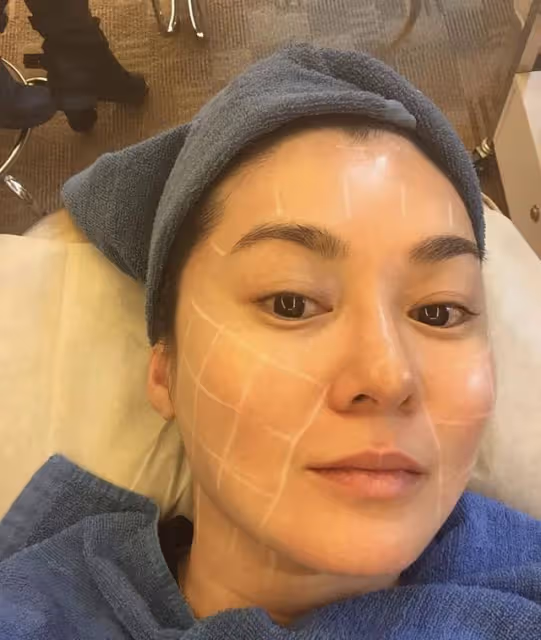 香港著名女星改名後罕見現身,打肉毒桿菌留下後遺症,蘋果肌搶鏡