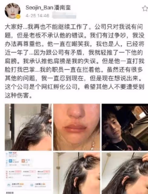 捲走前夫10億財產整容,被老闆掌摑險些毀容的潘南奎,如今怎樣?
