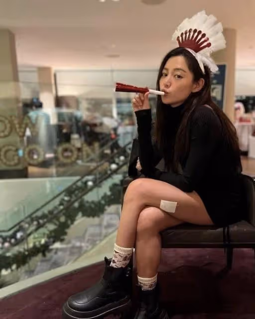 擔心！英皇女星自曝平安夜受傷，大腿驚現血痕，入院縫四針