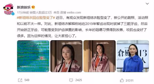 新垣結衣顏值暴跌,全網炸鍋,一切竟是整牙惹的禍?