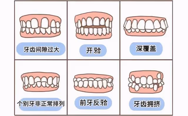 新垣結衣顏值暴跌,全網炸鍋,一切竟是整牙惹的禍?
