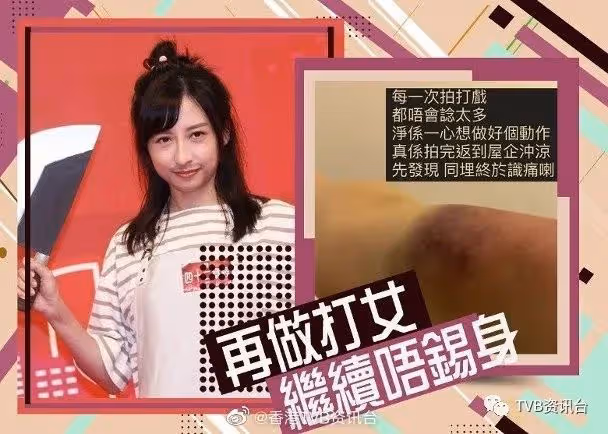 打到周身傷龔嘉欣慣咗唔識痛!