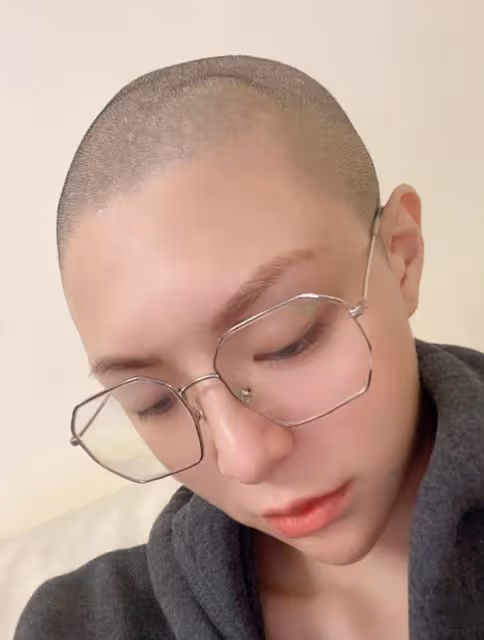 美女網紅自曝患腦腫瘤!已有10年險失明癱瘓,剃光頭手術恐懼崩潰