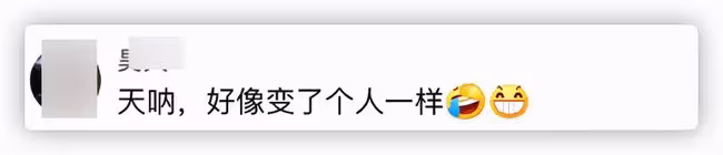 本山傳媒嬌嬌自曝整容,曬術後照被指認不出,多次割眼皮腫脹明顯