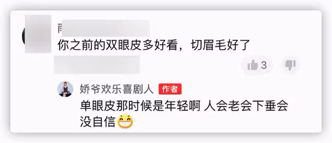 本山傳媒嬌嬌自曝整容,曬術後照被指認不出,多次割眼皮腫脹明顯