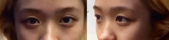 終於有人整成鞠婧禕!一比一復刻,看來沒少花錢啊