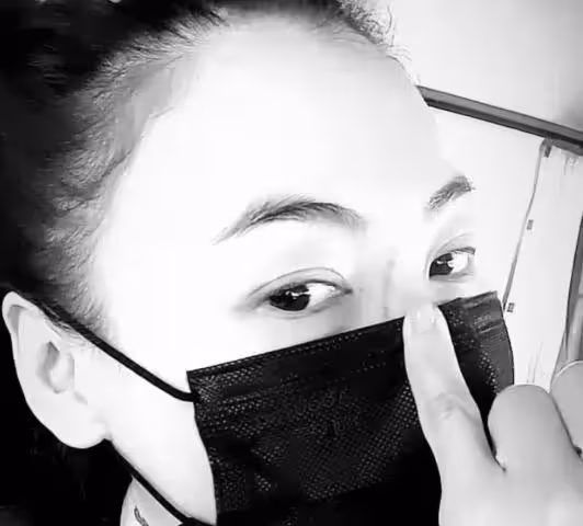 張柏芝臉被抓傷，鼻樑傷口長達3厘米，網友：和新老公打架造成？
