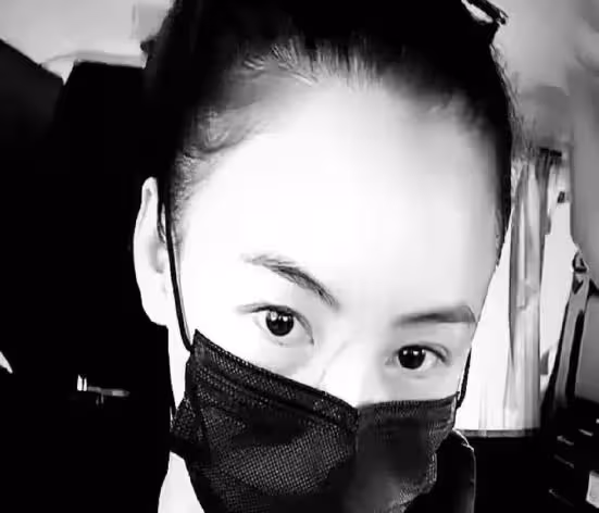 張柏芝臉被抓傷，鼻樑傷口長達3厘米，網友：和新老公打架造成？