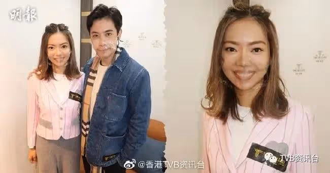 跟李日朗簽約TVB!林熹瞳曾小產留陰影:現在飲食好小心