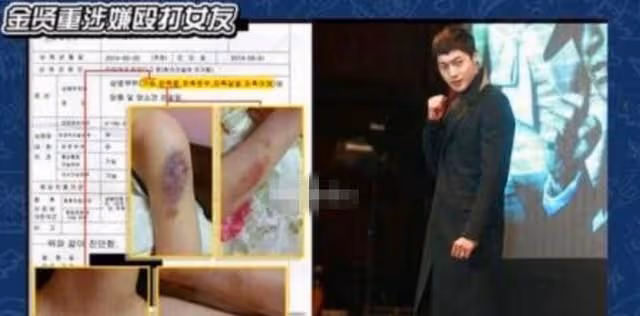 家暴、酒駕、醜聞讓他人設糊地穿心,但他的顏值卻從沒讓人失望過