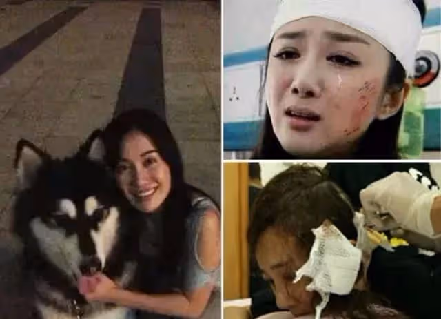 「古裝第一美人」李依曉,被葉璇的狗咬毀容,今成惡毒女配專業戶
