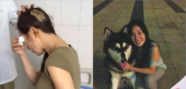 「古裝第一美人」李依曉,被葉璇的狗咬毀容,今成惡毒女配專業戶