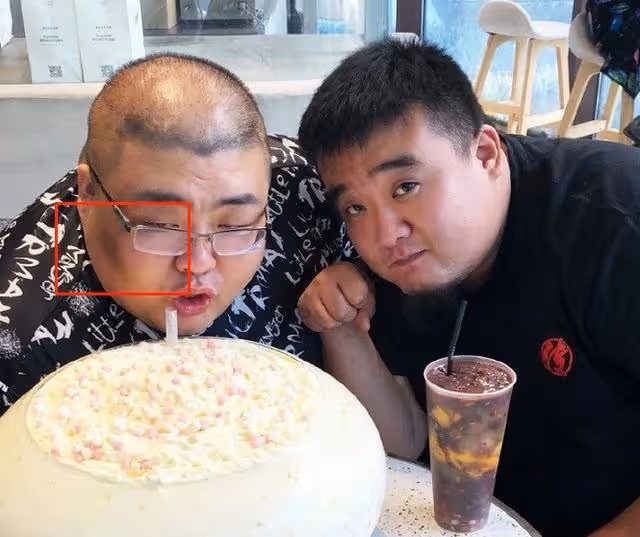 8大吃播就這樣寫下了結局:有人為保命減肥,有人變聲、牙齒脫落