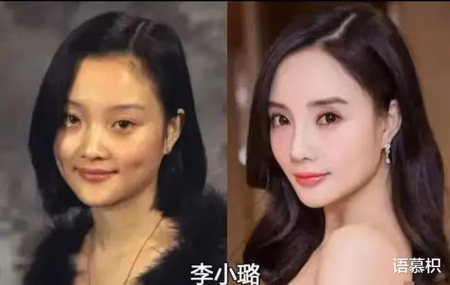娛樂圈就是整容場？開掛式逆襲？明星出道前後對比，你認出了幾個