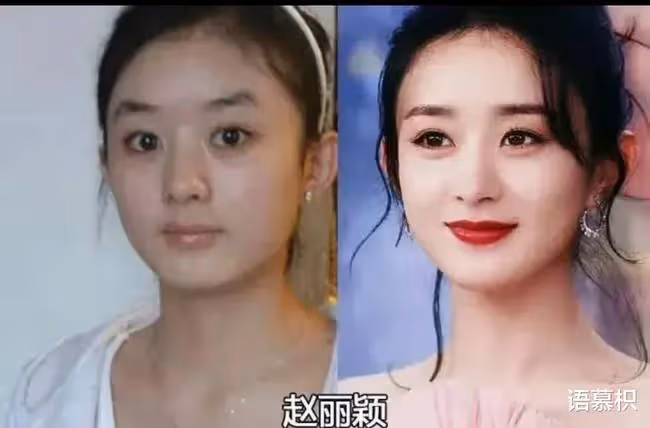 娛樂圈就是整容場？開掛式逆襲？明星出道前後對比，你認出了幾個