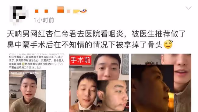 男網紅咽喉不適去醫院檢查,毫不知情被「整容」,鼻子坍塌慘毀容