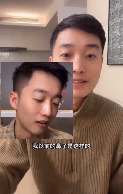 男網紅咽喉不適去醫院檢查,毫不知情被「整容」,鼻子坍塌慘毀容