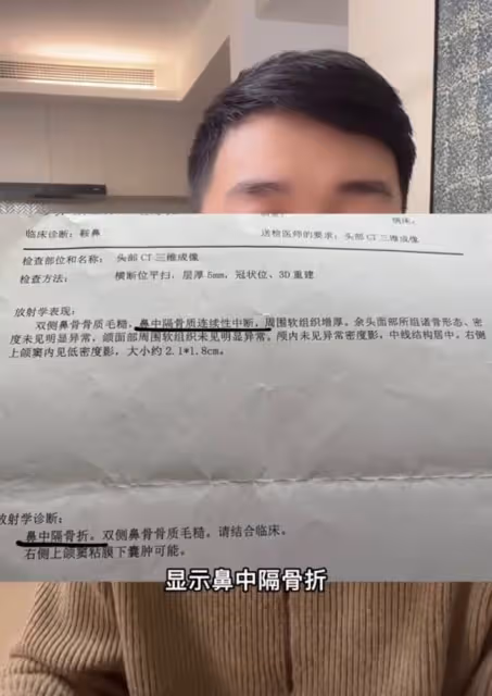 男網紅咽喉不適去醫院檢查,毫不知情被「整容」,鼻子坍塌慘毀容