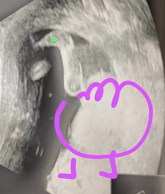 TVB前著名女星首度公開孕照,上圍變豐滿孕味足,預產期在六月