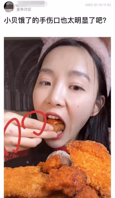知名吃播小貝餓了又被指催吐!手指關節傷口似牙印,大批粉絲質疑