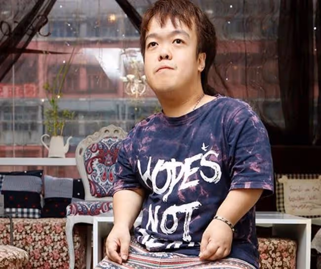 36歲男星先天發育不全，身高1米33受盡歧視，感謝馮德倫提攜入行
