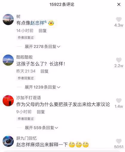 四歲女孩酷似趙忠祥,被曝光後遭全網惡意嘲諷,孩子只是生病了!