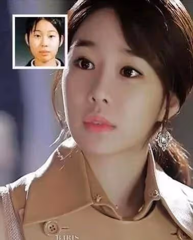 整容的極限是什麼？「萬年女二」告訴你，老娘除了變美還有演技