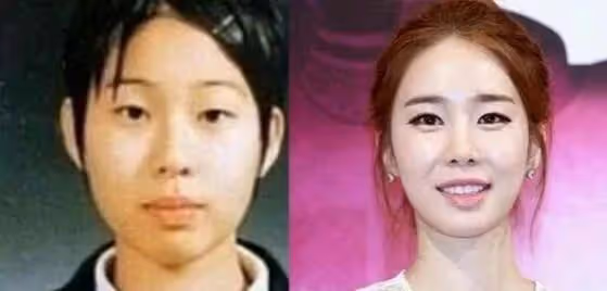 整容的極限是什麼？「萬年女二」告訴你，老娘除了變美還有演技