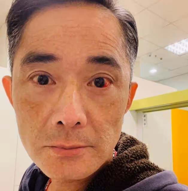 54歲男星微血管破裂,一個月出血3次!前妻自殺後他承諾終身不娶