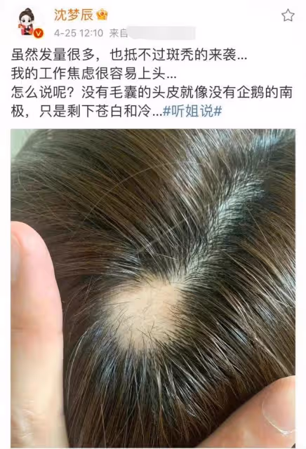 沈夢辰被批炫富!高調開300萬豪車摳鼻屎,杜海濤曾七夕送其奔馳