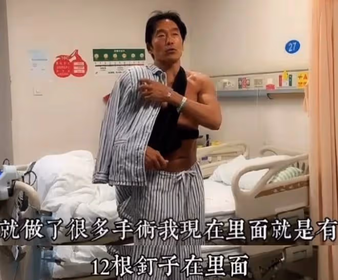 56歲港星詹瑞文在內地受傷，靠手機找醫院治療，大讚方便服務好