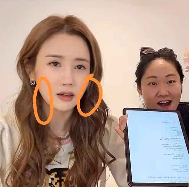李多海近照又變臉,臉變大像中年女人,曾是李易峰深愛的前女友