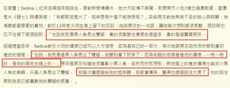 Selina雙腿傷疤像魚鱗 男友一句話就讓她痛哭,任爸認可未來女婿