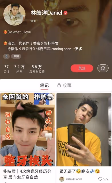 《香蜜》男星分享整容歷程，曾瘋狂填充面部，一口牙被吐槽像馬桶