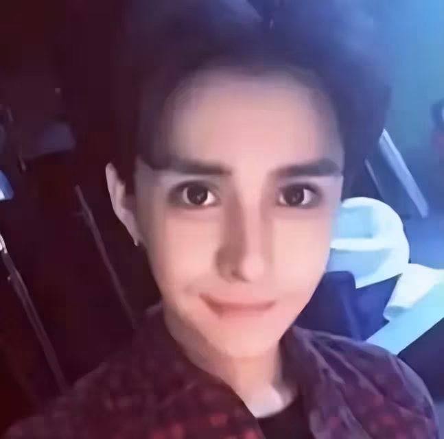 《香蜜》男星分享整容歷程，曾瘋狂填充面部，一口牙被吐槽像馬桶