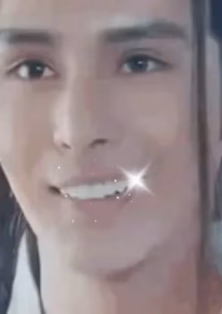 《香蜜》男星分享整容歷程，曾瘋狂填充面部，一口牙被吐槽像馬桶