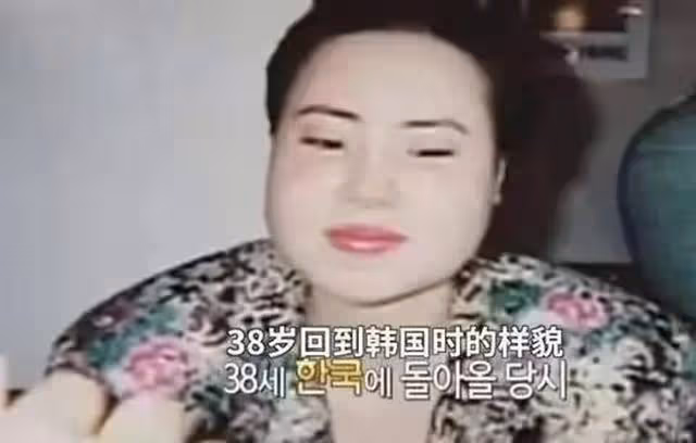 「電風扇阿姨」韓慧景:為變漂亮用食用油注射全臉,9年無法閉眼