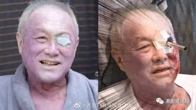 搏到盡全L露股!陳山聰不清場照剝未驚過